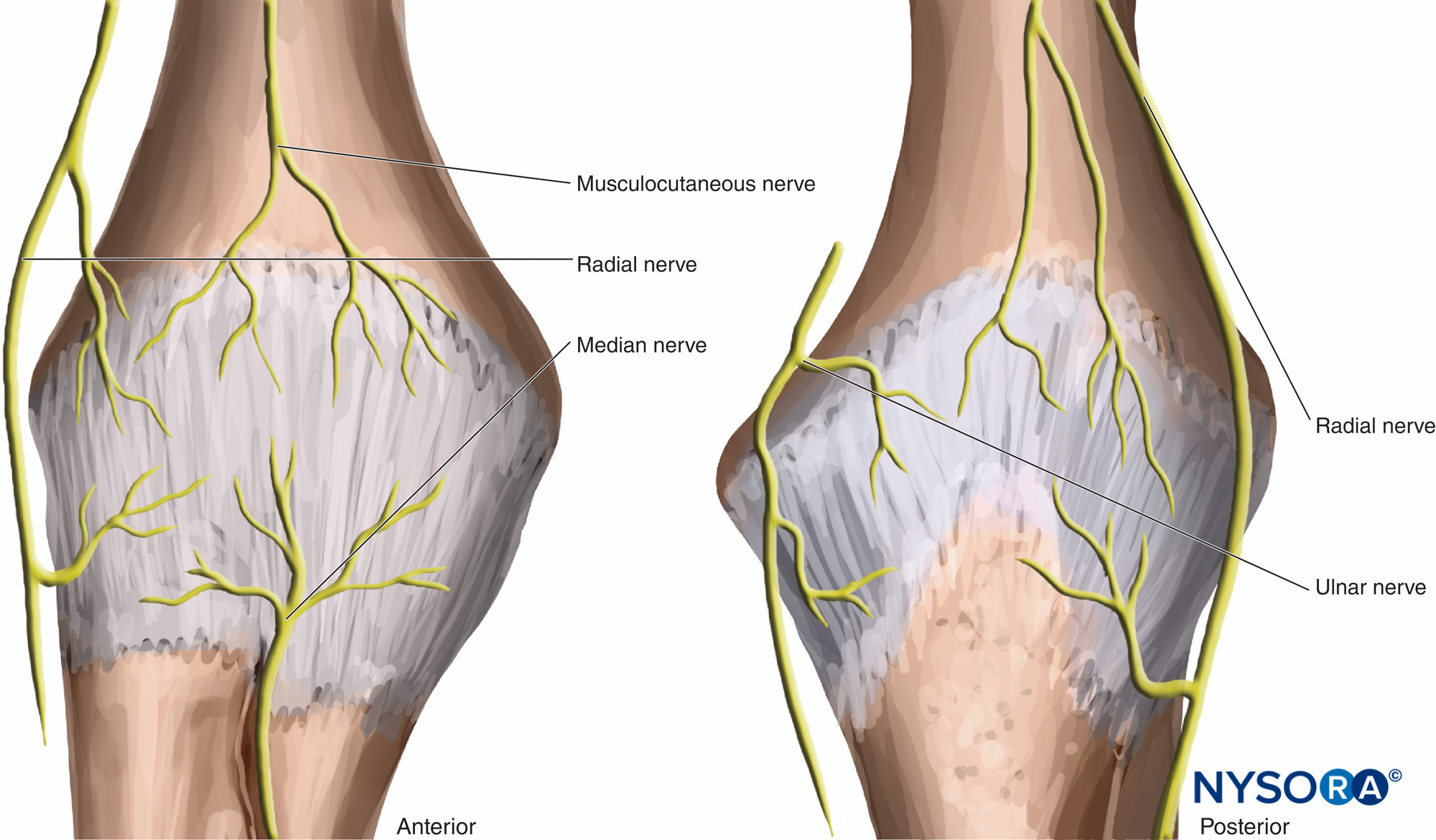 knee-arthritis-pain-is-caused-by-nerves-acupuncture-dry-needling