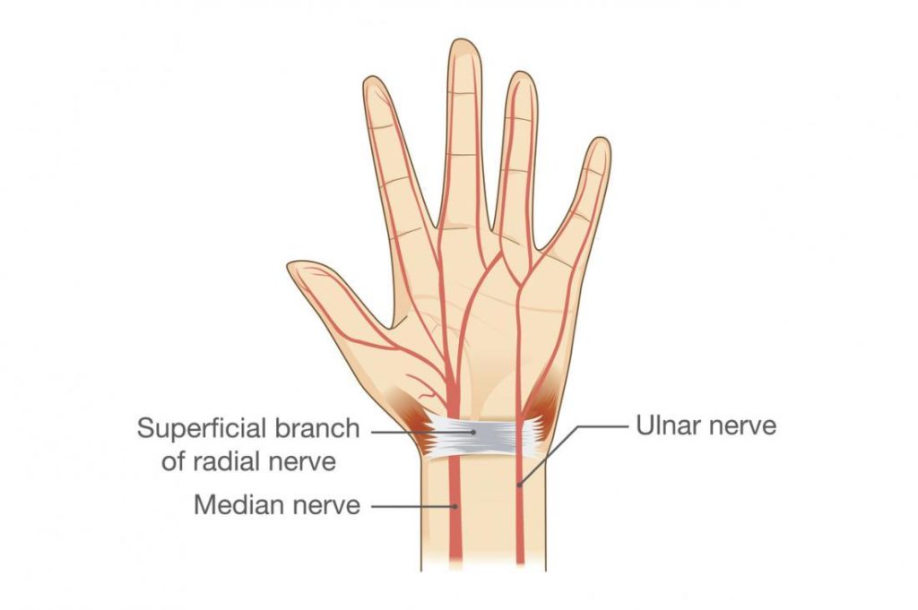 What Does Nerve Pain In Fingers Feel Like