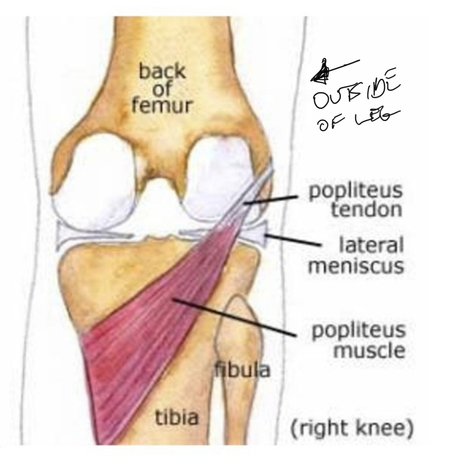 What Causes Your Knee To Lock Up? Hint: It’s Not The Meniscus 