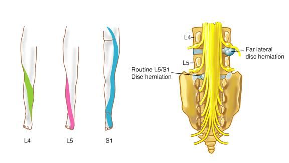 why-is-my-big-toe-numb-acupuncture-dry-needling-prolotherapy-in