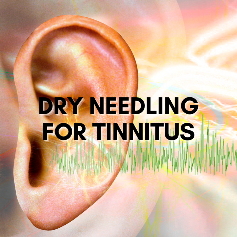 Can dry needling help tinnitus? Acupuncture , Dry Needling
