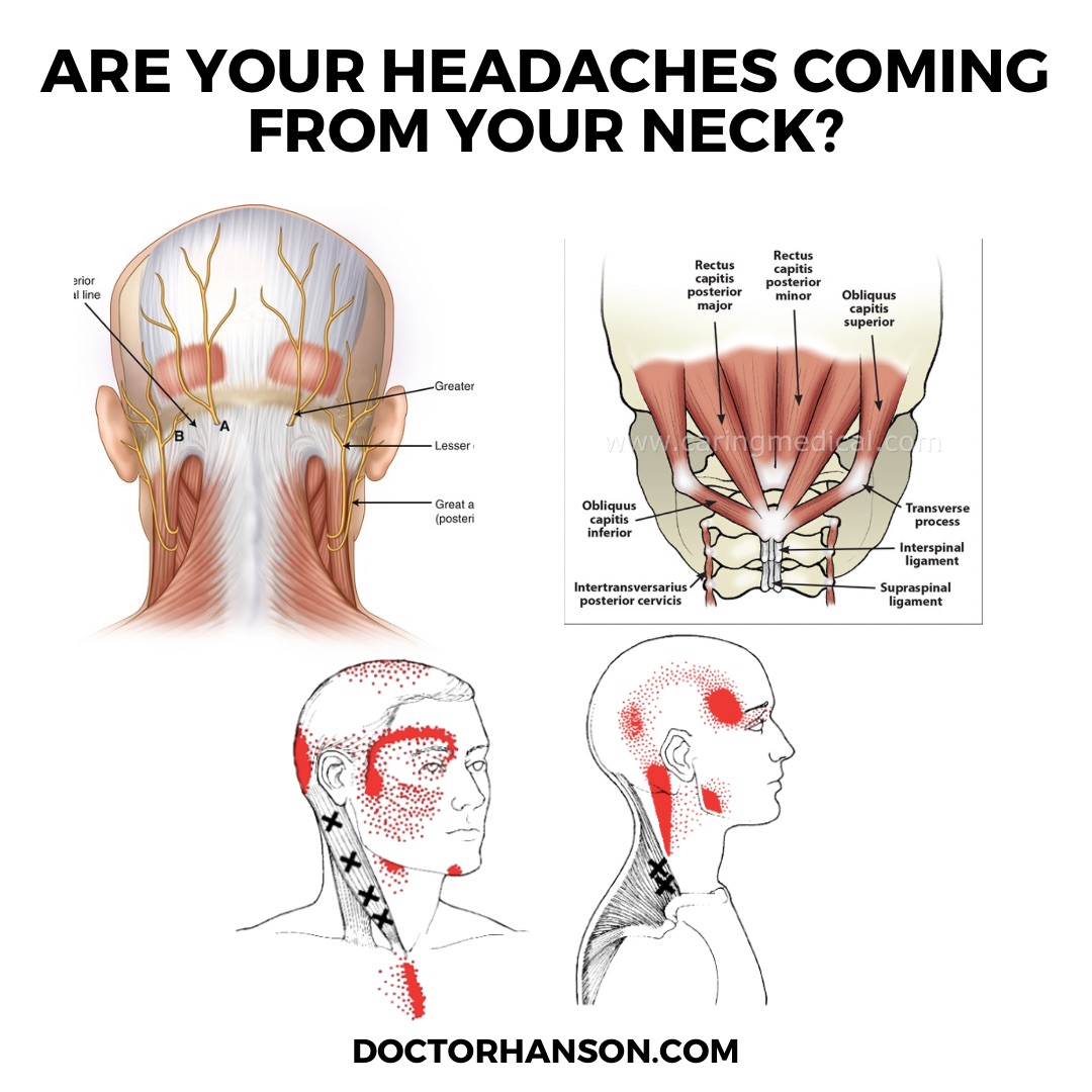 Can Neck Problems Cause Tightness In Head