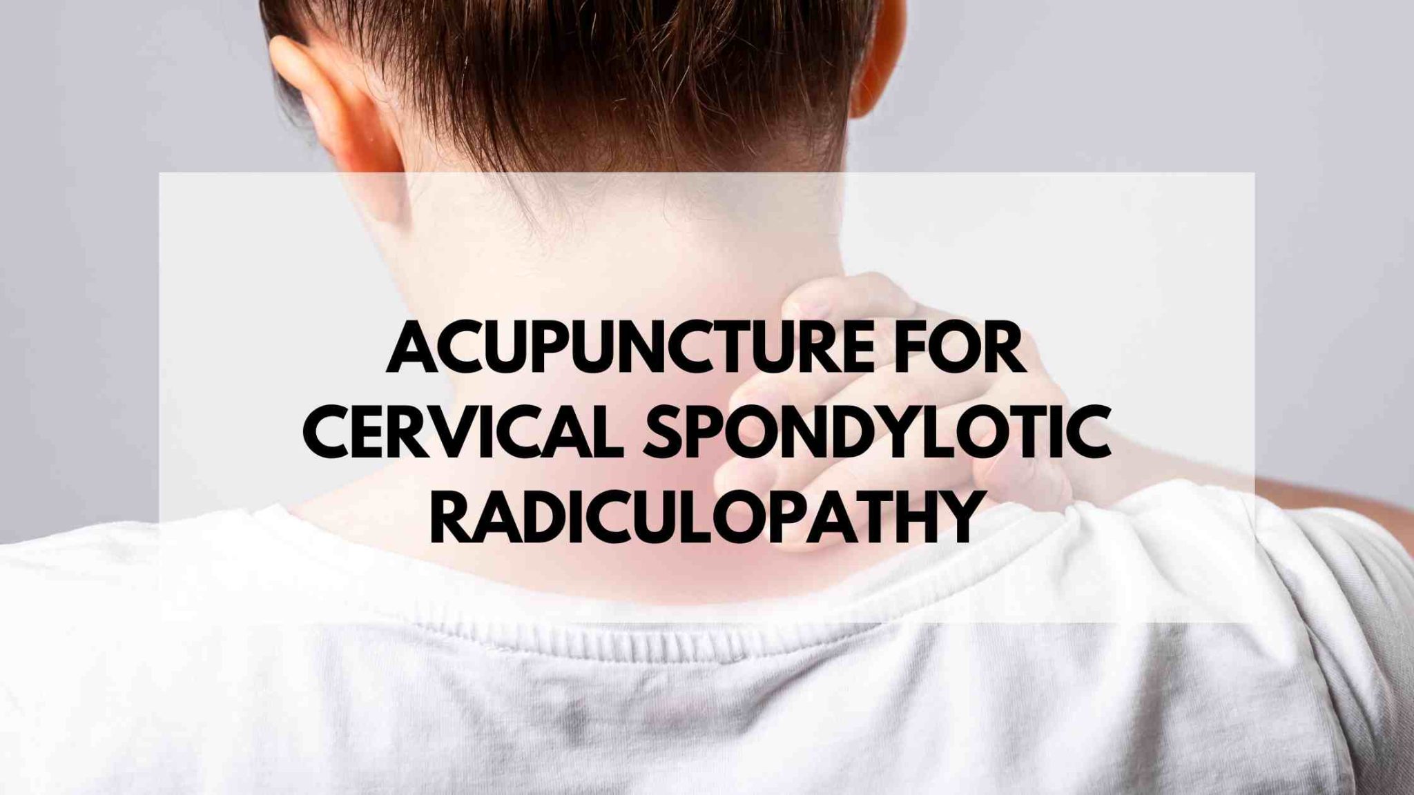 Acupuncture For Cervical Spondylotic Radiculopathy Acupuncture Dry Needling Prolotherapy In