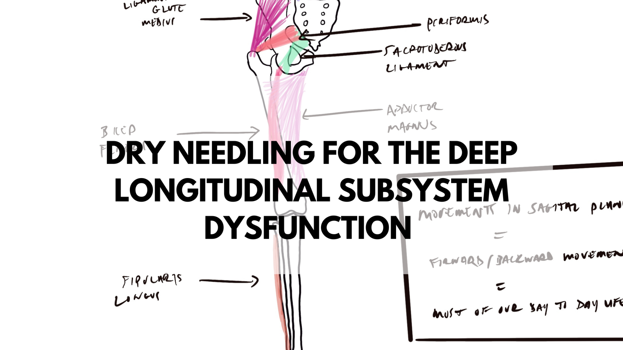 Dry Needling for the Deep Longitudinal Subsystem Dysfunction - A Common ...